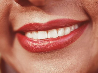 Red smiling lips with teeth showing.